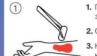 Step 1: wound preparation